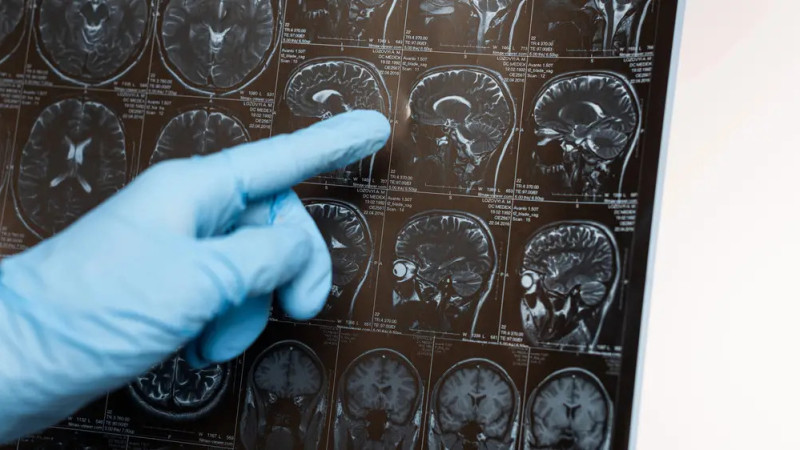 Время против разума: как дефицит свободного времени влияет на деменцию?