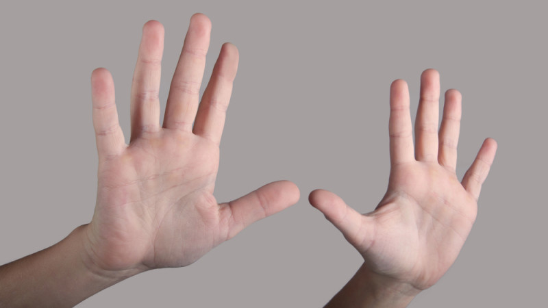 Врач развеял миф: хруст костяшек не вызывает артрит