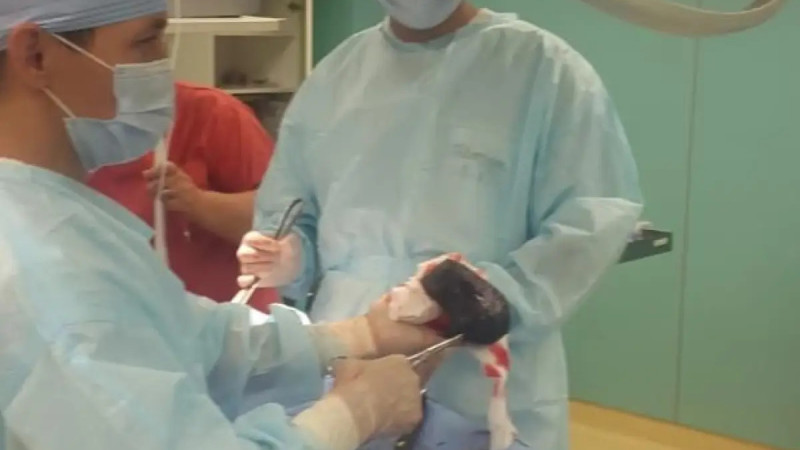 В Алматы врачи извлекли ком волос из желудка пациентки