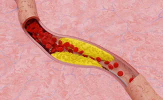 Назван неожиданный фактор повышения уровня холестерина в крови