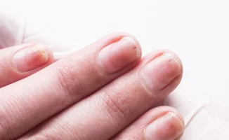 Симптомы рака: как распознать подногтевую опухоль в городе